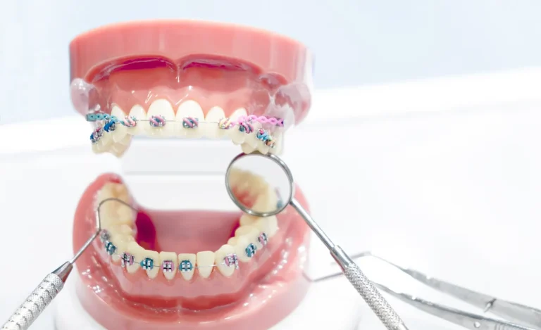 Pediatric Orthodontics