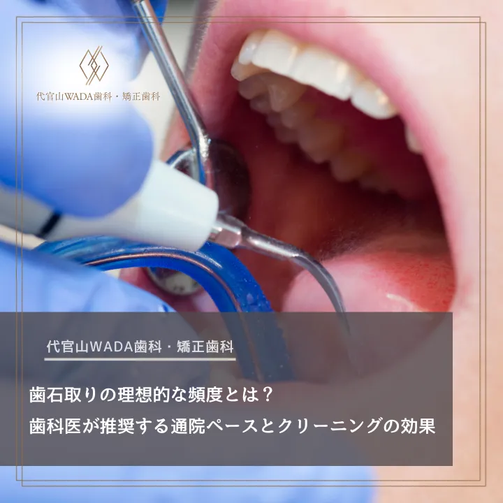 2026年3月20日_歯石取りの理想的な頻度とは?歯科医が推奨する通院ペースとクリーニングの効果