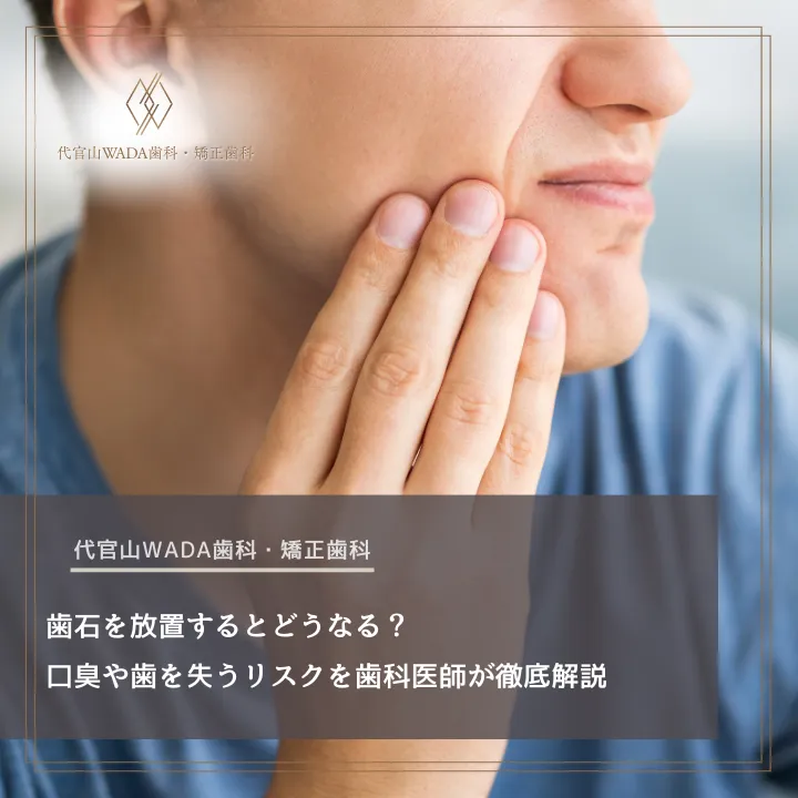 2026年4月17日_歯石を放置するとどうなる?口臭や歯を失うリスクを歯科医師が徹底解説