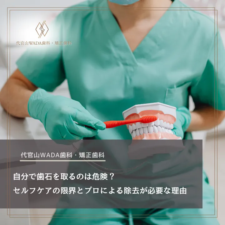 2026年4月3日_自分で歯石を取るのは危険?セルフケアの限界とプロによる除去が必要な理由